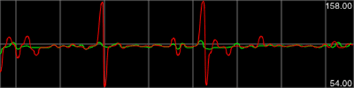 Nagle algorithm 1